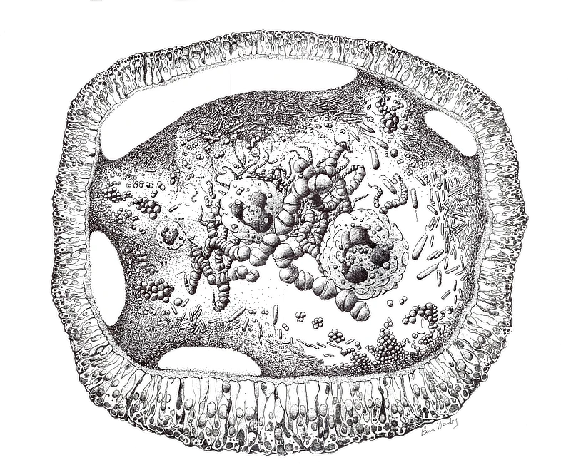 drawing of a cf lung